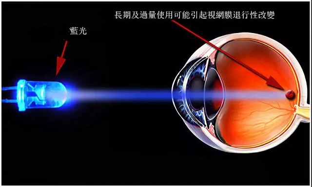 手机“护眼模式”反而会伤眼?竟和这个原因有关,大多数人没想到!