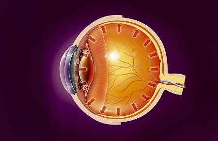 哪些青光眼可以通过白内障手术治疗