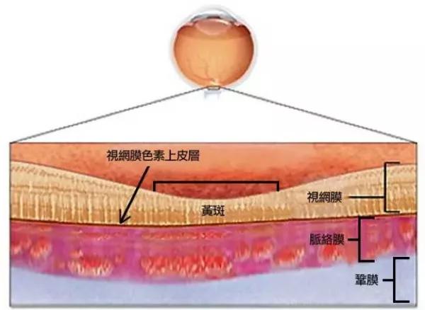 你真的了解视网膜吗？如果视网膜脱落可以这样治疗！